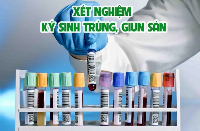 Khi nghi ngờ dấu hiệu nhiễm sán chó nên làm xét nghiệm kỳ sinh trùng để chẩn đoán đúng bệnh