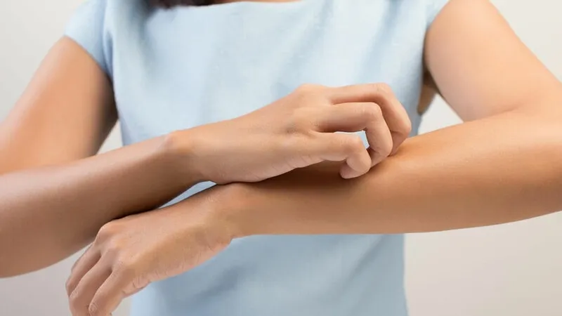 Mèo bị giun thường có biểu hiện sụt cân và lông xỉn màu