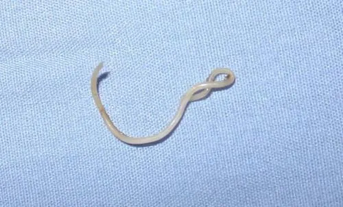 Toxocara canis gây ra các dấu hiệu nhiễm sán chó ở người